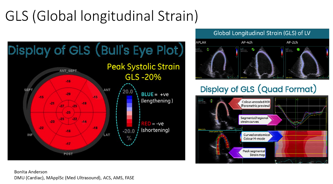 Global Longitudinal Strain (GLS - PART 1) 