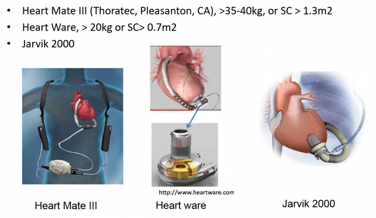 Basic Course in Pediatric Heart Failure and Heart Transplantation – Niakoro